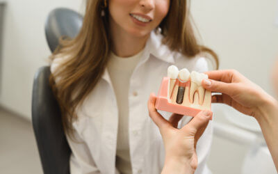 Qu’est-ce qu’un implant dentaire ? Explication de l’implantologie