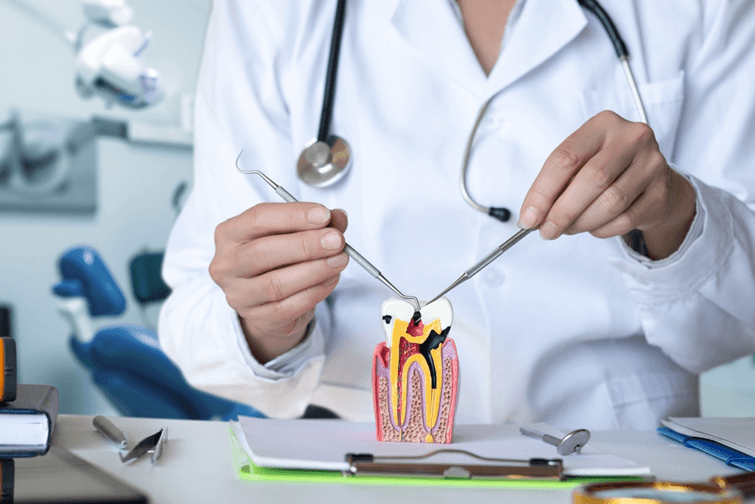 Le traitement de canal (endodontie) : déroulement et bénéfices