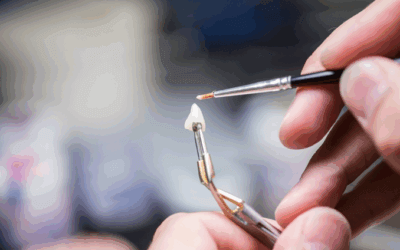 Les matériaux utilisés en dentisterie : céramique, composite, titane, zircone…