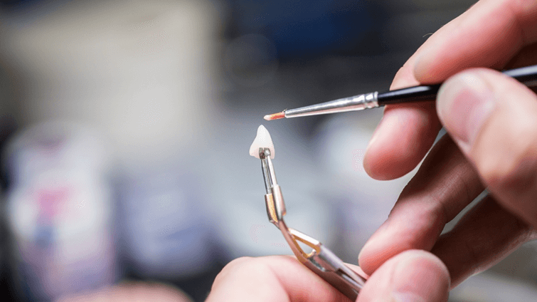 Les matériaux utilisés en dentisterie : céramique, composite, titane, zircone…
